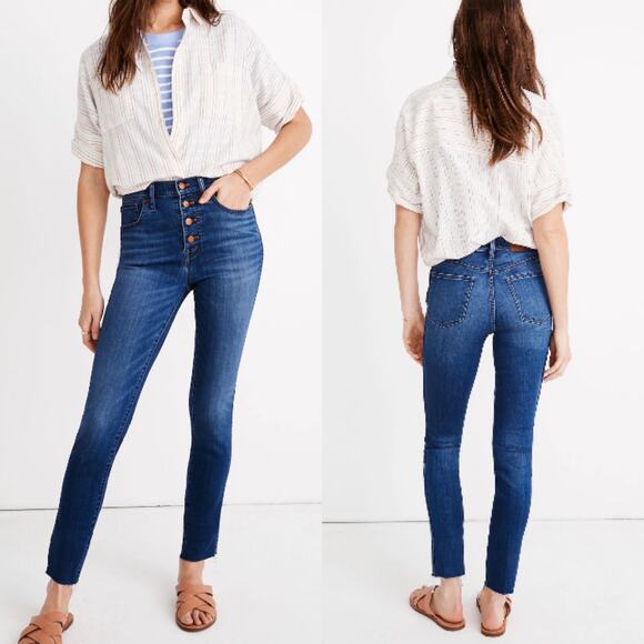 Madewell Button Front 10" High-Rise Skinny Crop Jeans - Picture 1 of 11